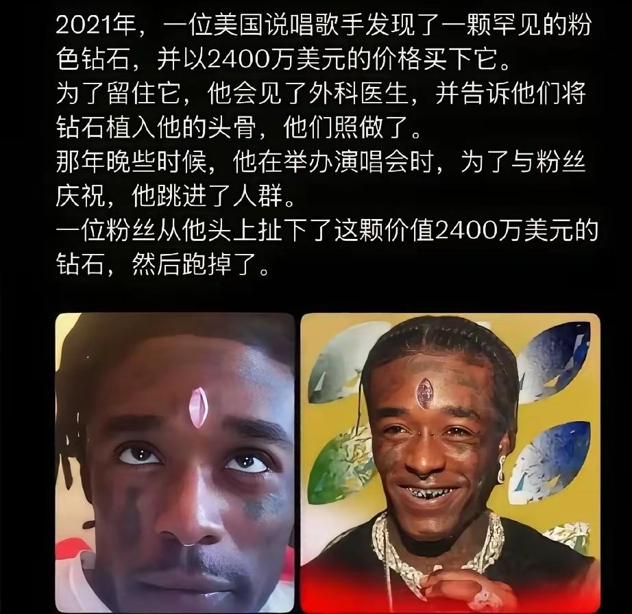 这哥们有点傻，竟然把那么名贵的钻石镶在额头上，没想到，被人直接拔走了。据说，这