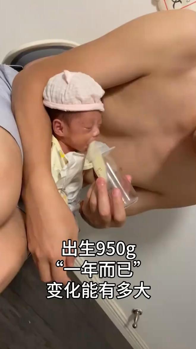出生950g，