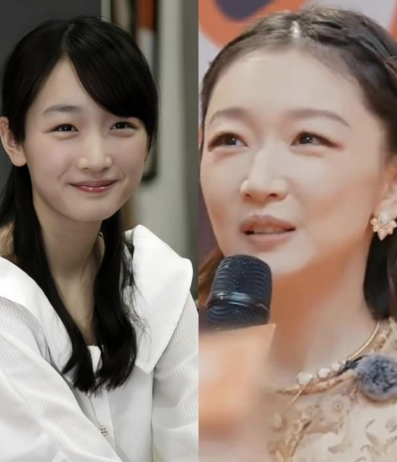 周冬雨亮相《周五晚高疯》红毯，杜海涛问周冬雨“你是因为整容让眼睛变大了吗”周冬雨