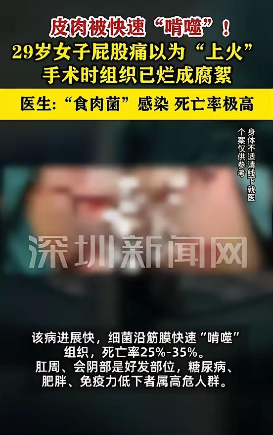 悲剧还是发生了！”7月25日报道，浙江，一女子肛周肿痛，她以为是“上火”，涂了药