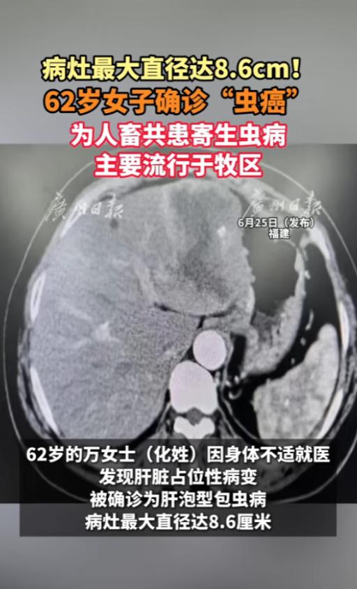 “人和宠物还是要分清楚！”6月26日报道，福建，一位62岁的女子身体不适到医院检