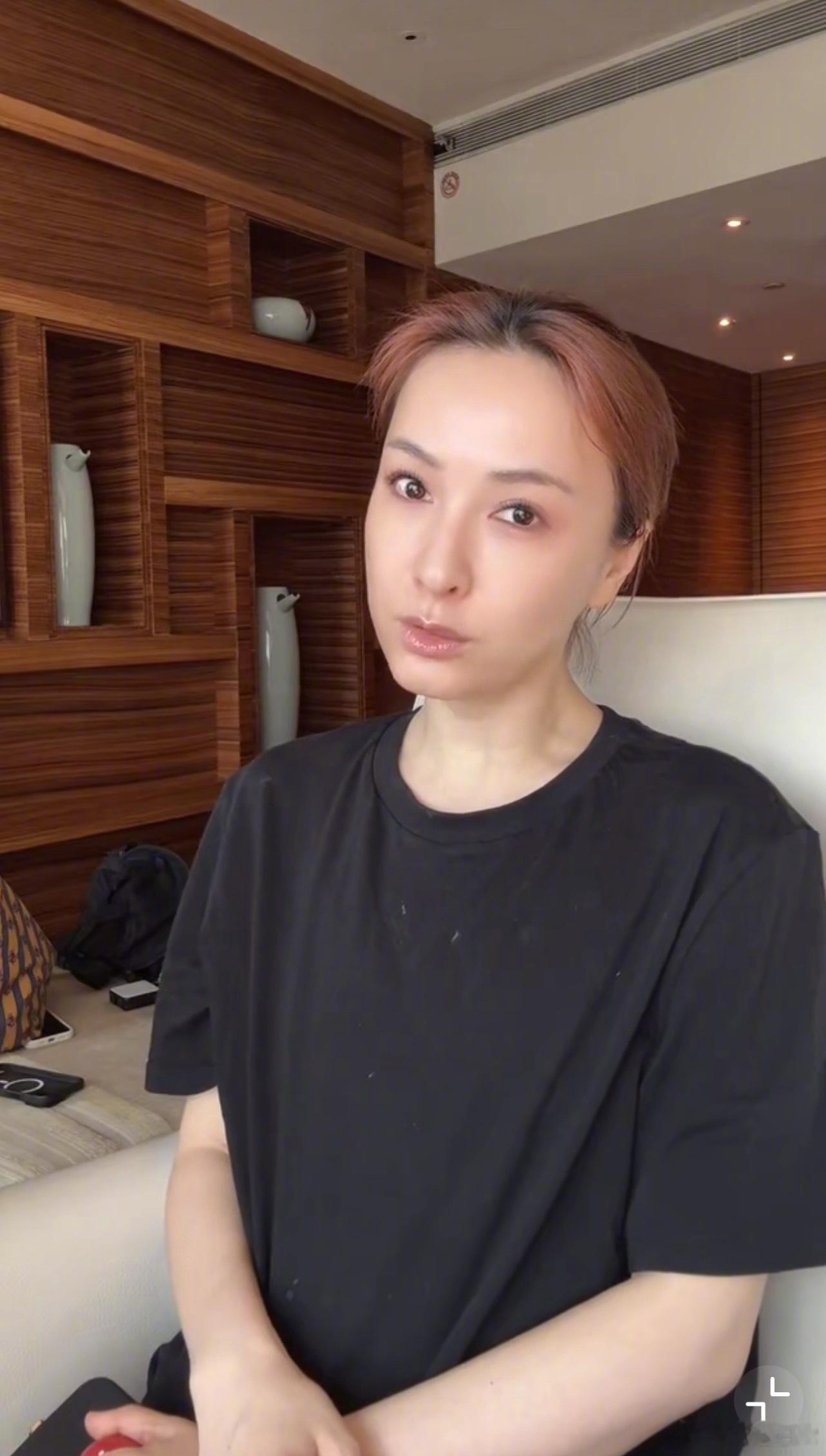 吴昕的脸说不上来但跟以前比感觉哪里变得不一样了吴昕的脸怎么了​​​