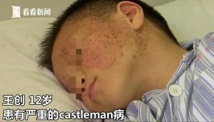 12岁男孩肤如蟾蜍 看到图片震惊了