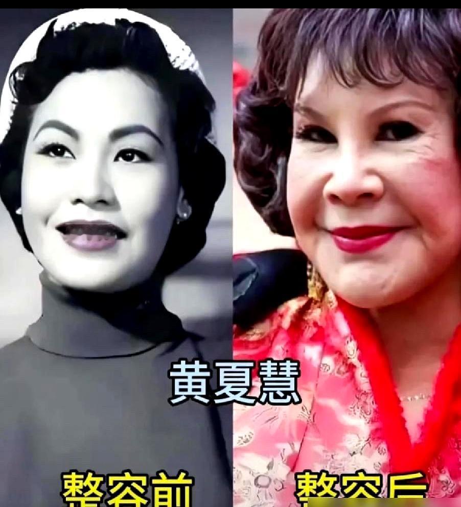 你敢信？昨晚我刷手机看到昔日的春晚女神，揉了三次眼睛愣是没认出来，这届女星的脸
