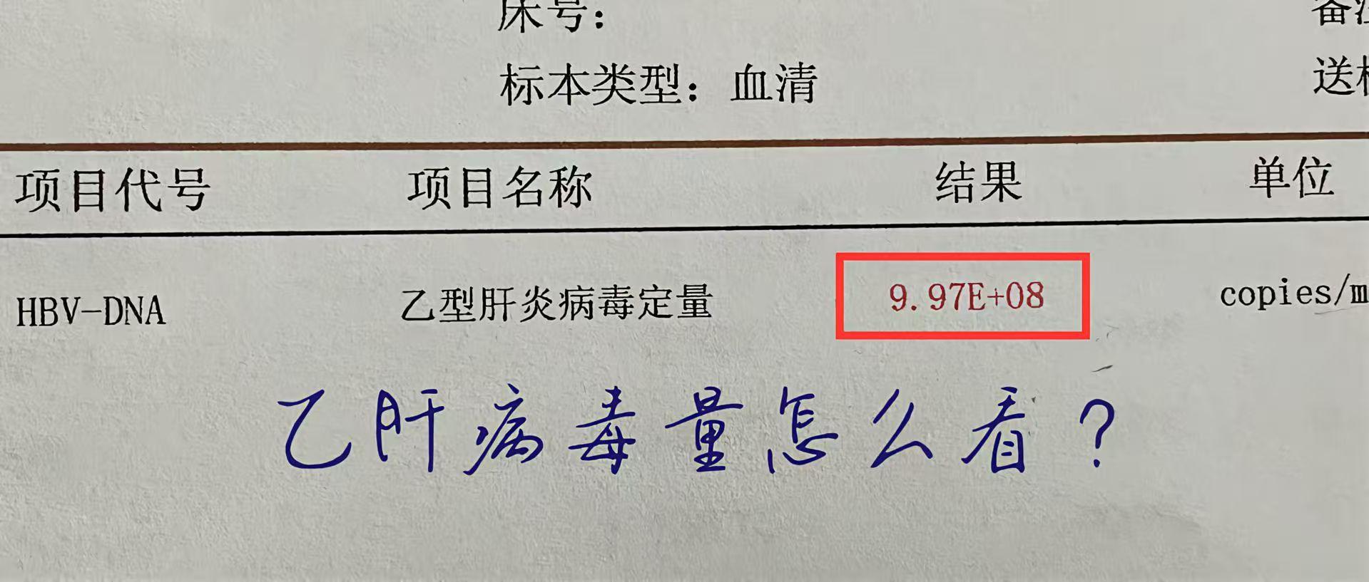 乙肝病毒量应该怎么看？   很多患者拿到乙肝病毒量检查单子后，看不太明...
