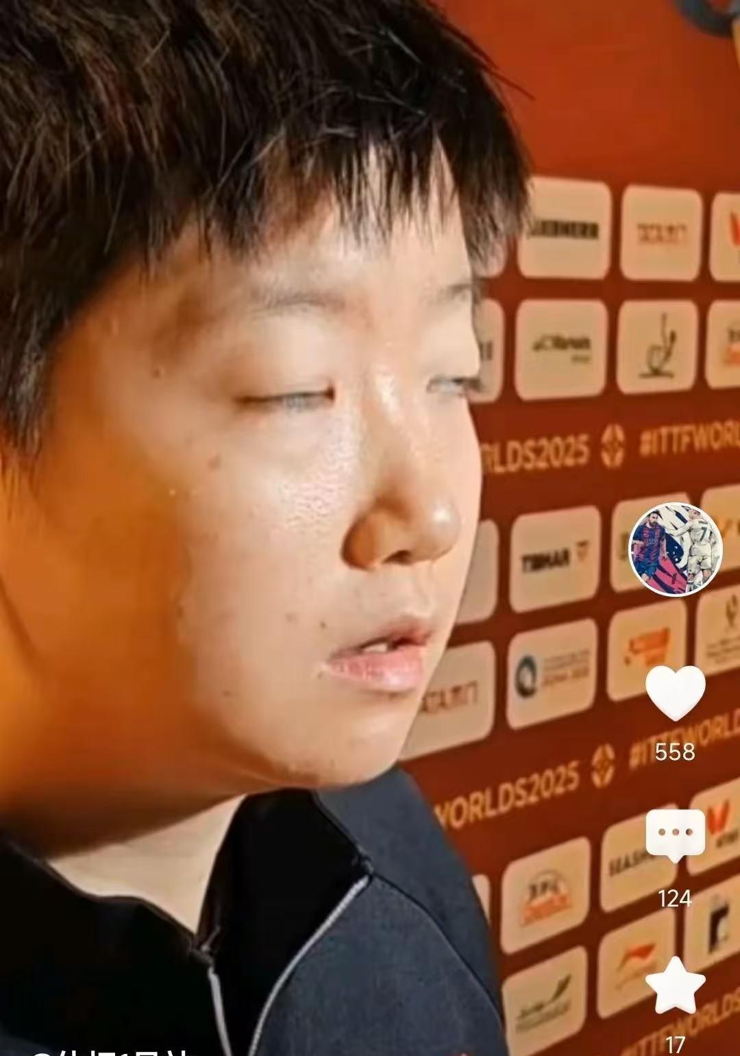 孙颖莎头有白头发成了球迷热议的话题，有主播说她可能打球压力太大了，才25岁就肉眼