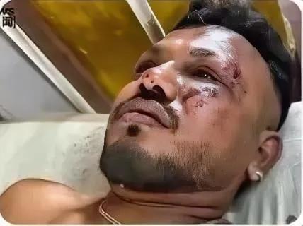 奇迹生还！男子接完父亲电话30秒后飞机坠毁爆炸，独活轻伤震惊专家：他拯救过银河系？