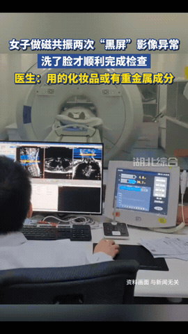 “解释不清了！”福建一29岁女生头晕，去医院做头颅磁共振。不料，连续2次扫描，都