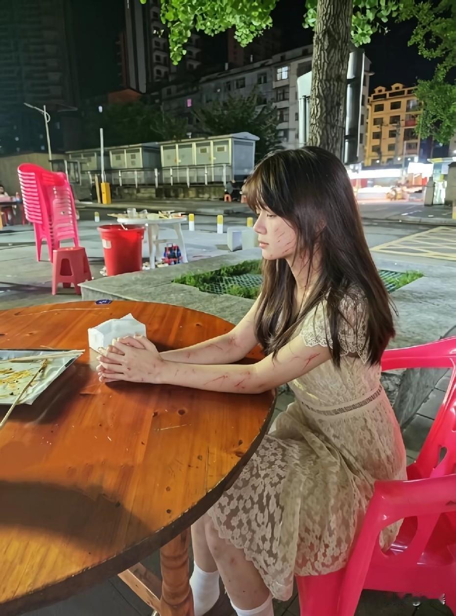 看上去又不像男的打的，全是抓痕，有点像女的抓的。有点故事