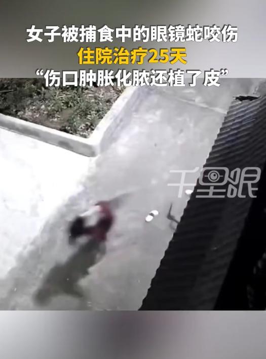 “命真大啊！”云南红河，女子在院子里乘凉时，意外被捕食癞蛤蟆的眼镜蛇咬到脚，不到