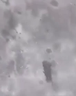 事实证明，炮弹运用得当，有治疗伤员的作用。1名受伤不能动弹的俄军士兵躺在担架上，