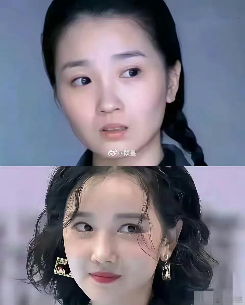 陈小纭这是医美太严重导致的吧？跟之前完全两模两样了。​​​