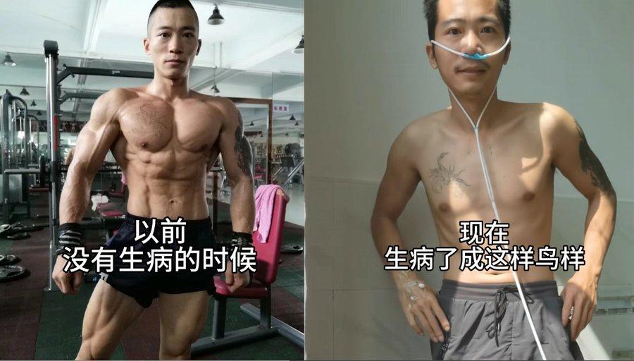 高强度地锻炼肌肉，到底是好是坏？看看这位仁兄就知道了
