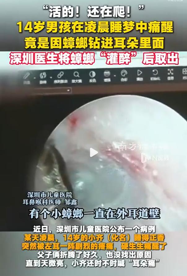 掏一下几十块，捅穿几千块：深圳男孩耳内活蟑螂，棉签为何是元凶？据南方日报9月