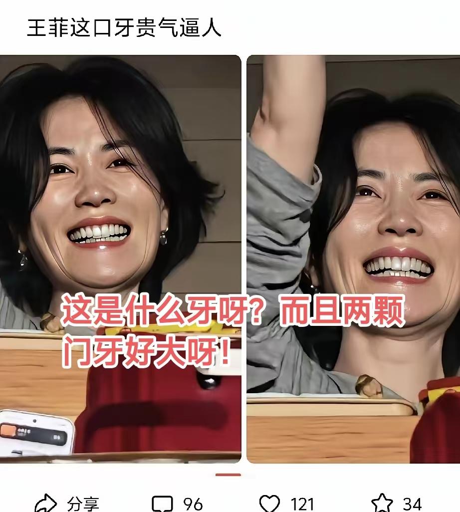 天后，这两颗门牙，好不协调