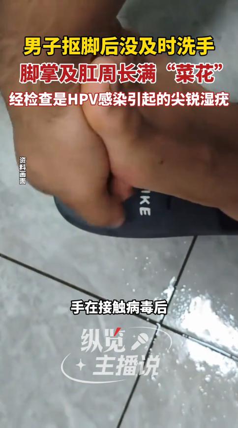 悲剧还是发生了！2023年，江苏南京，一男子因患有脚气，总是忍不住的去挠，结果把