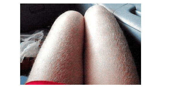 新生儿的腿像“猴子”? 孕妈在孕期不要吃这些食物