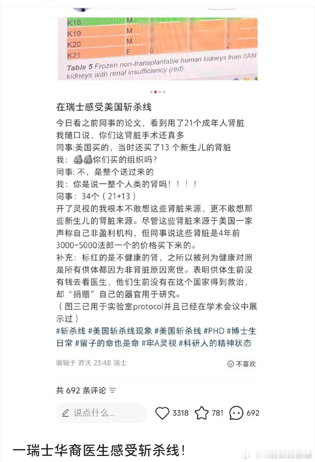 在瑞士感受到了美国斩杀线瑞士华裔医生留言同事的论文做实验用了21个成年人肾脏＋1