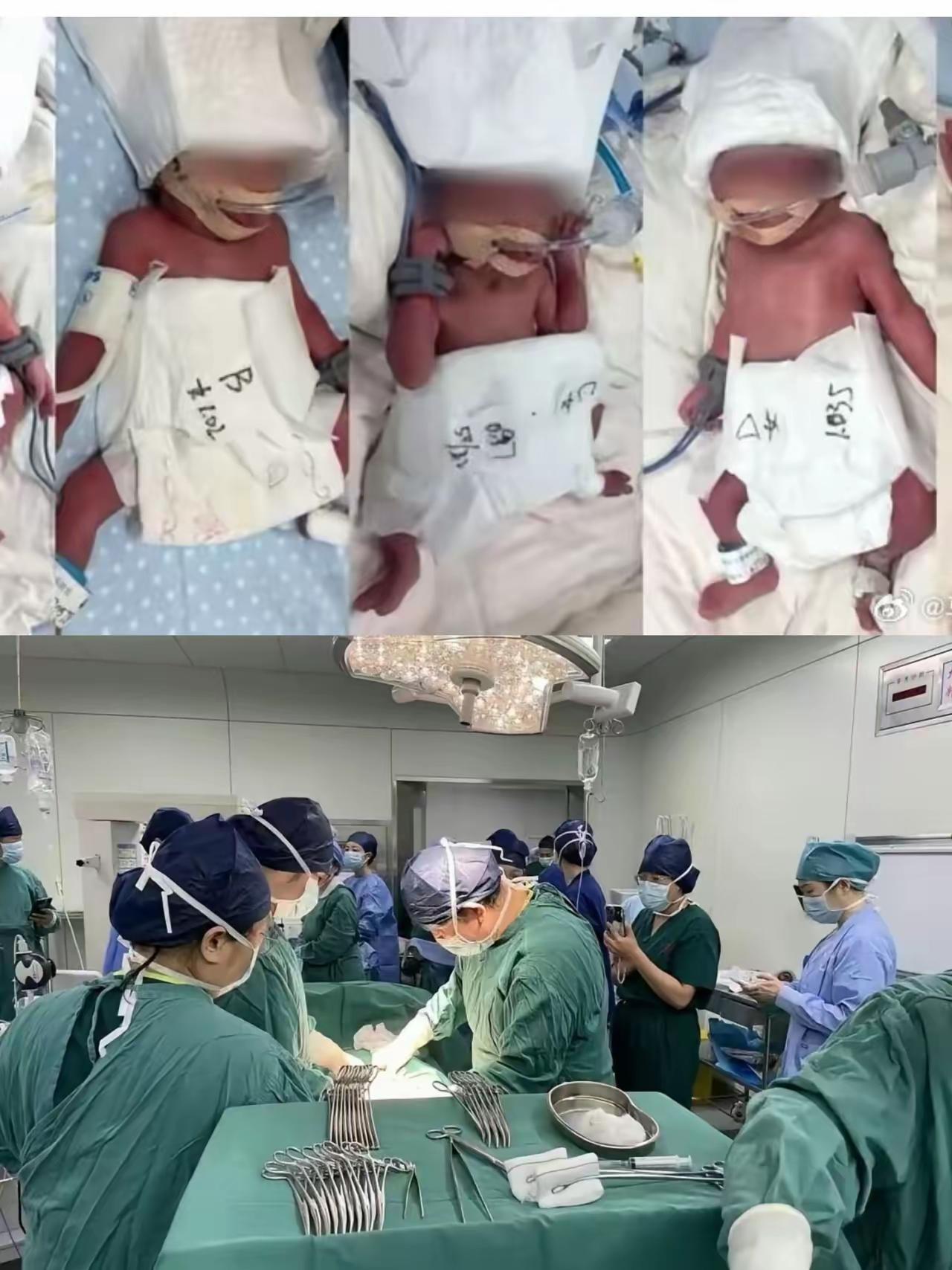 终于弄明白5胞胎妈妈为什么要跨越几千公里到武汉医院，找李家福医生接生了！​