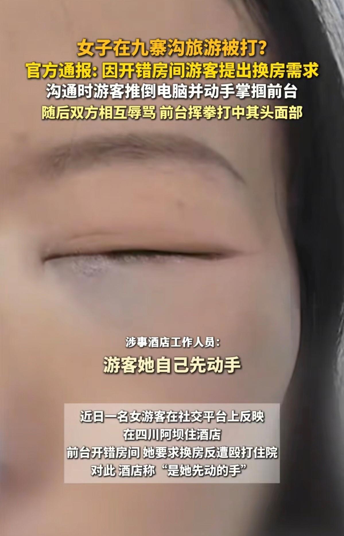 九寨沟游客被打鼻青脸肿！先扇男服务员耳光，反击来得太快！该女子本来开开心心