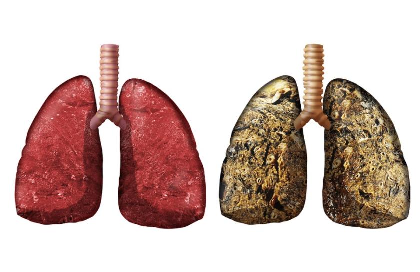 别再自欺欺人了！你以为吸烟只是伤肺？最新研究实锤：这是在给肺“灌水泥”！🚬美