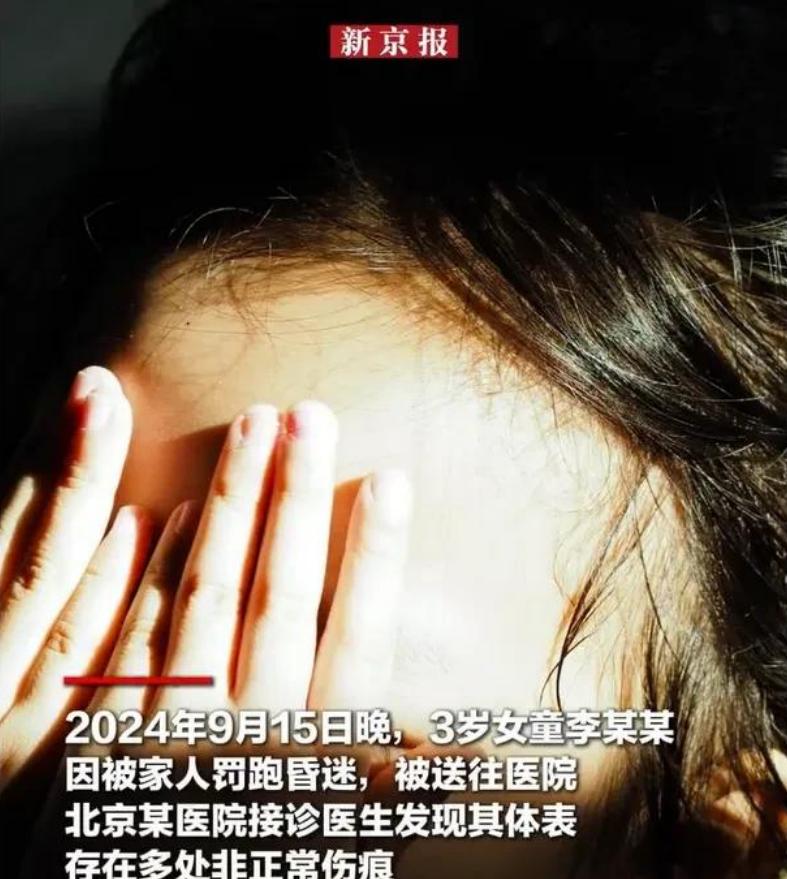 三岁女童被父母长期虐待，晕倒送医后真相大白。2024年9月15日深夜，北