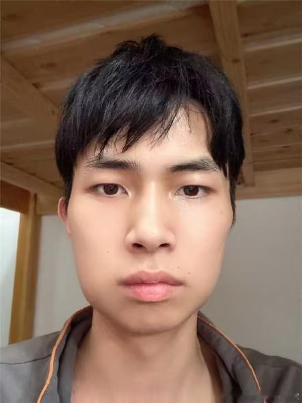 滔搏电竞俱乐部王者荣耀KPL长沙滔搏我的天，玖欣拔完智齿怎么变国字脸了又心疼又好