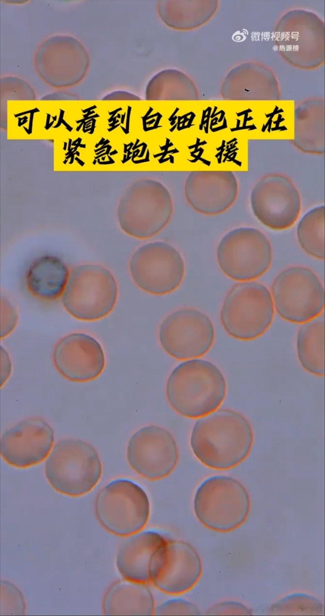 指尖血放大看我们每个人像不像白细胞？拼命的维护美好​​​