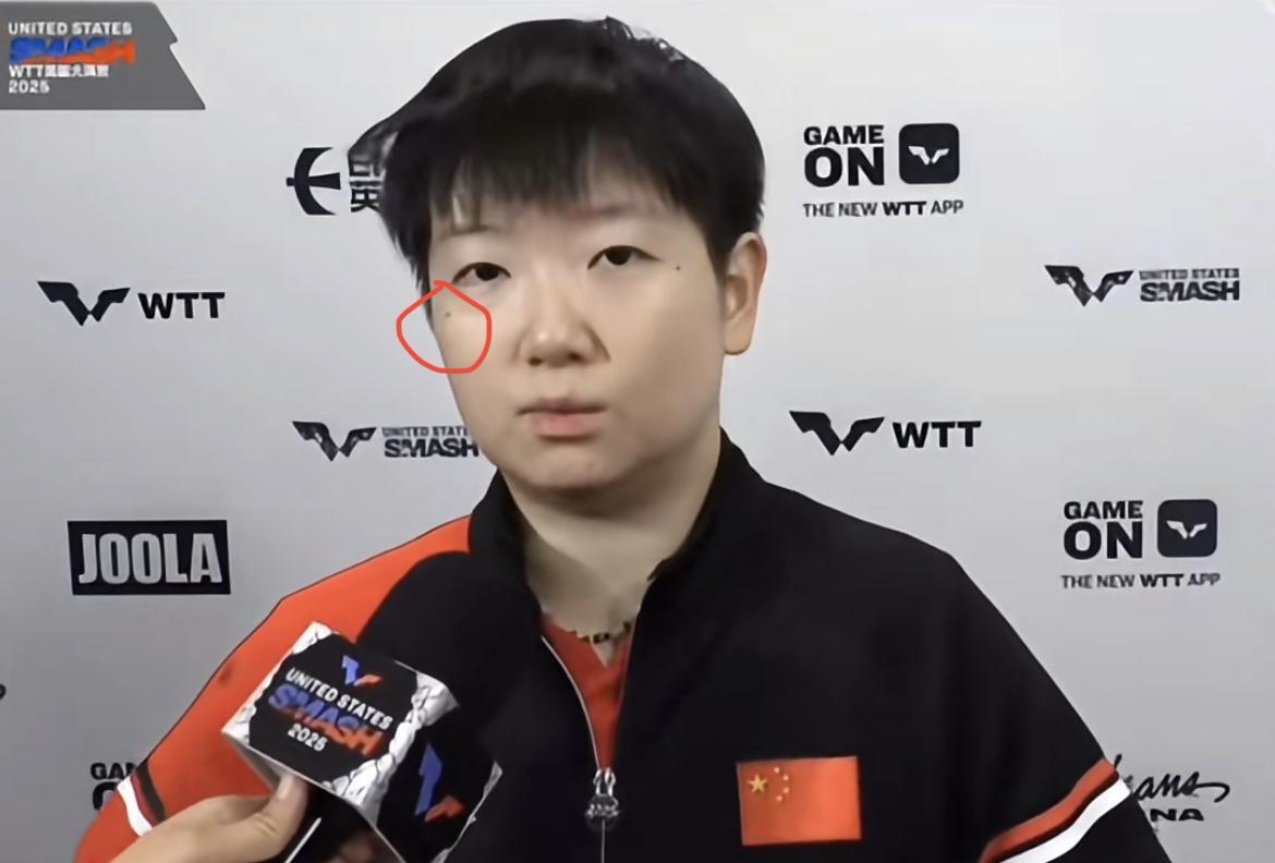 有些人对莎莎要求太高，3:2不行，必须3:0，第一场比赛又是遭遇战，打成这样很正