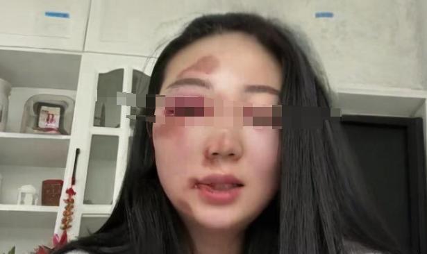 女婿昨天把女儿打了，我气的问啥原因，为什么敢打我的宝贝女儿，女婿说，女儿每天下班