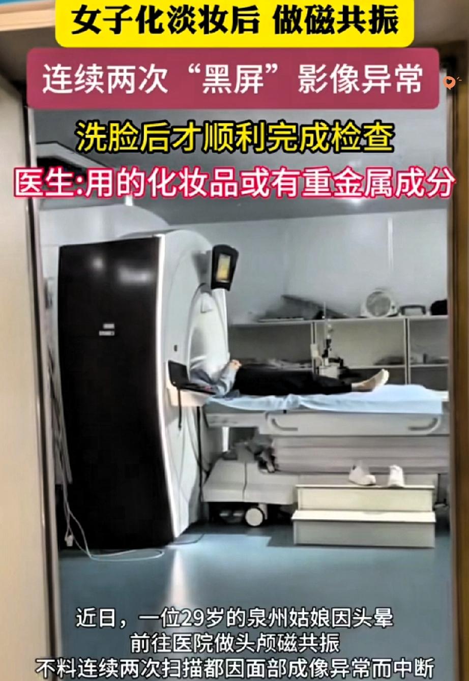 解释不清了！做磁共振居然败在了一张脸上，这事真的太颠覆认知了。福建一位2