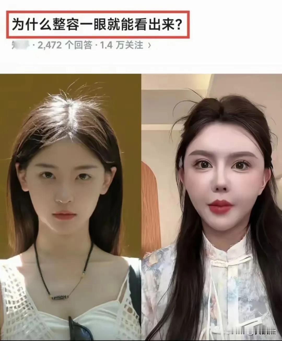 为什么有些女的，明明长得很好看？偏偏还要去整容，结果整的乱七八糟，甚至有些女