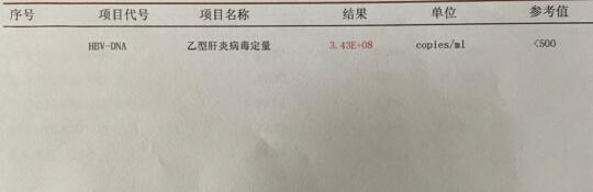 这位乙肝朋友病毒量都已经8次方了，还没开始治疗，大家千万不要像他一样！...
