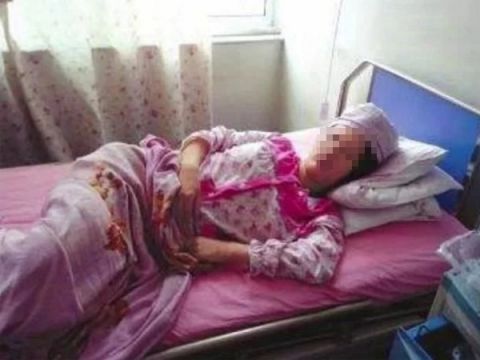 刚出生的婴儿, 脸上却有两处大伤疤, 没想到“下黑手”的是亲妈!