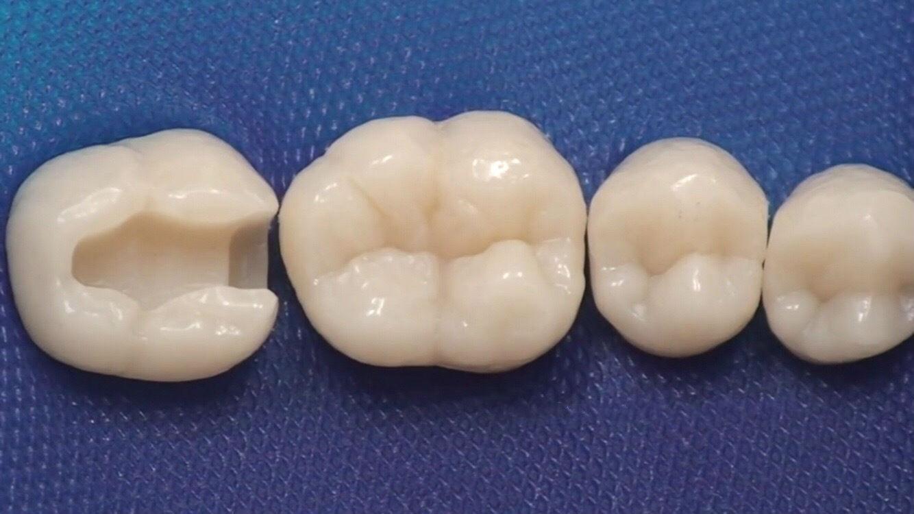 别急, 听牙医给你讲讲补牙后引发牙齿疼痛的四个原因