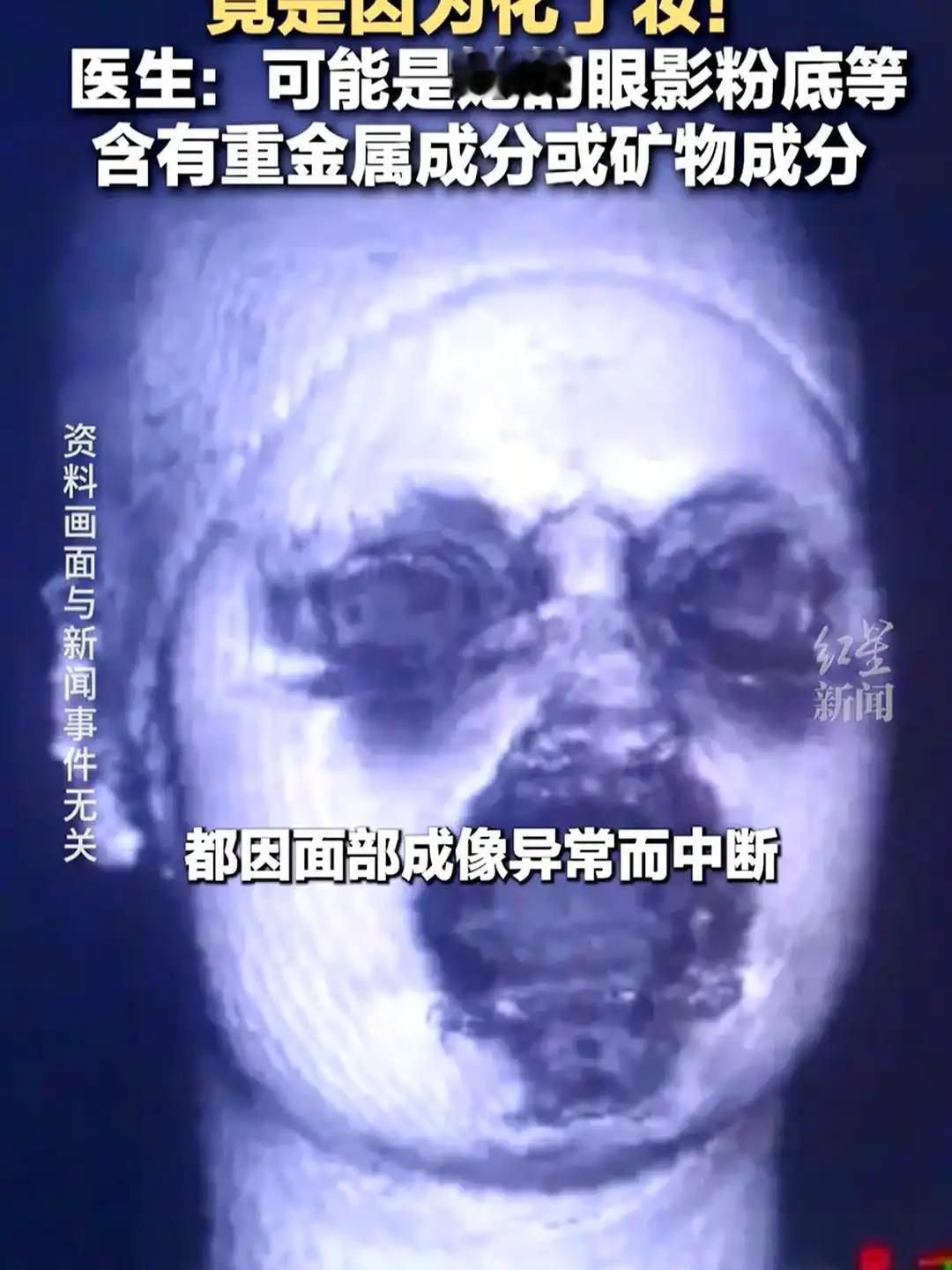 福建泉州有个女子，因为头晕去看医生，做了核磁共振检查时，屏幕竟然两次“黑屏”。大