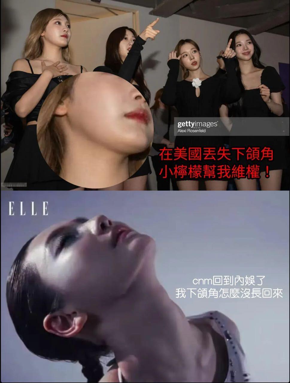 台湾娱乐分析宁艺卓下颌角的变化​​​