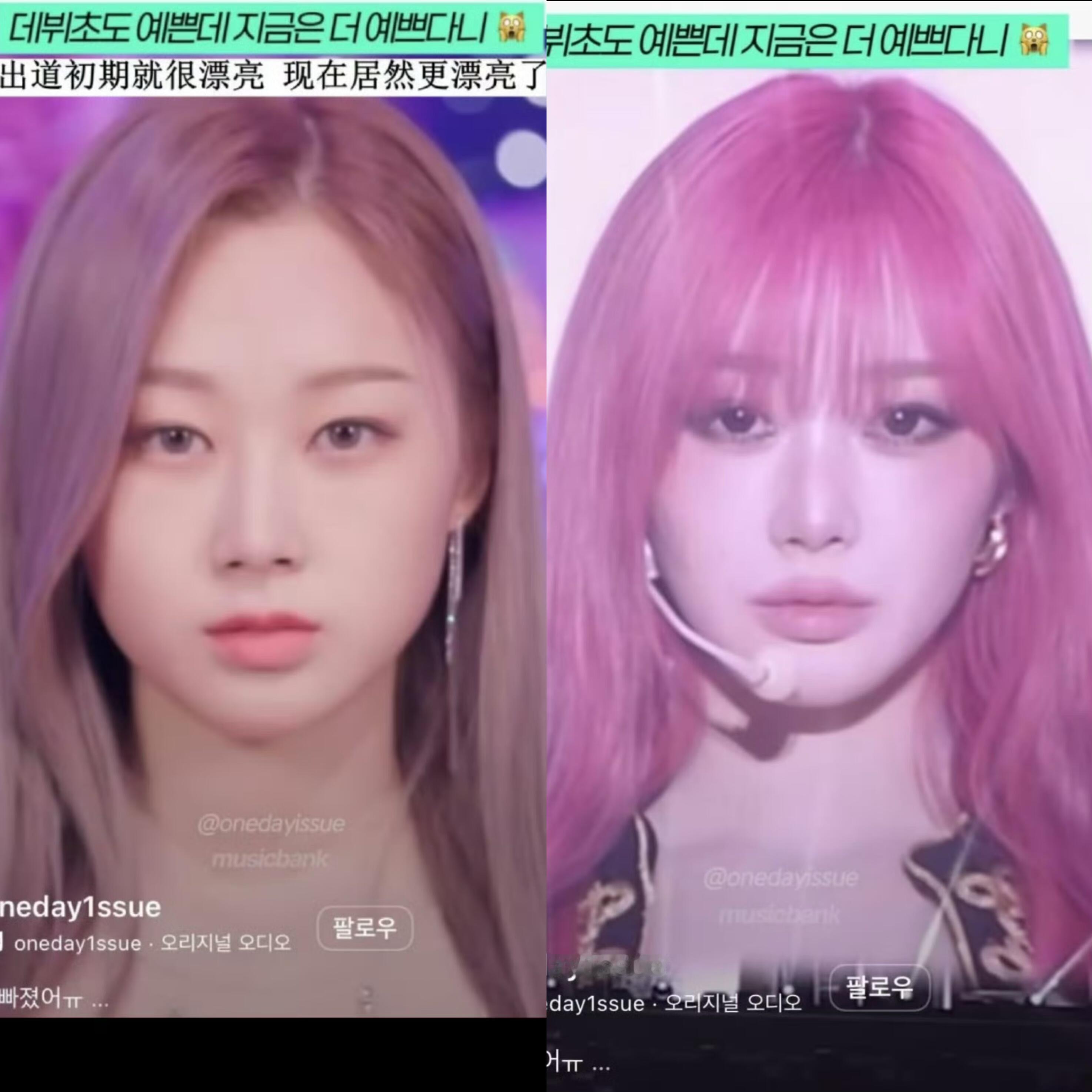 吉赛尔脸型变化最重要的是下巴​​​