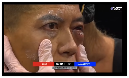 通背拳传人被几个耳光KO了, 算不算传武的至暗时刻?