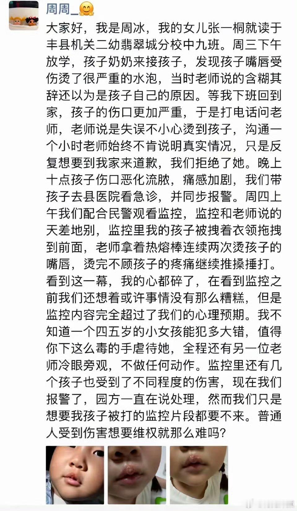 女童被幼儿园老师用热熔胶烫嘴虐待人怎么能这么坏！监控真是个好东西，就该全面普及。