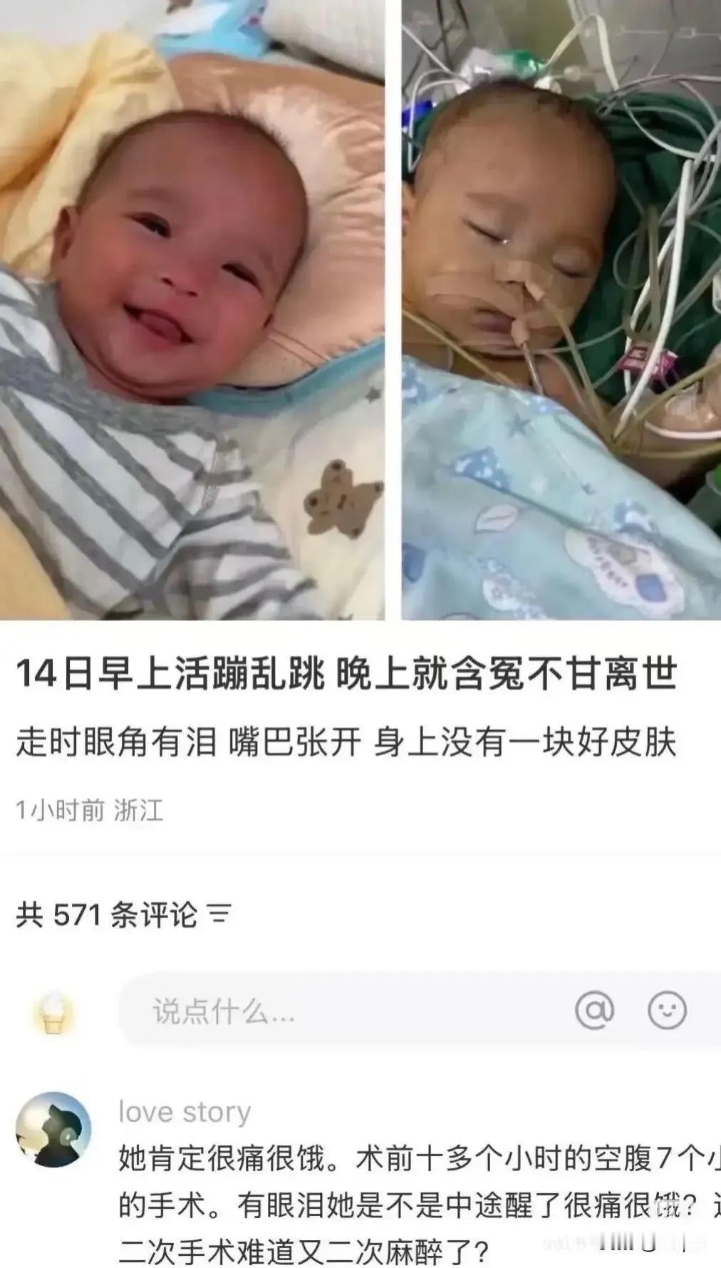 这个孩子你们有关注吗？卵圆孔未闭。医生要求手术，父母救子心切，同意手术。也没多想
