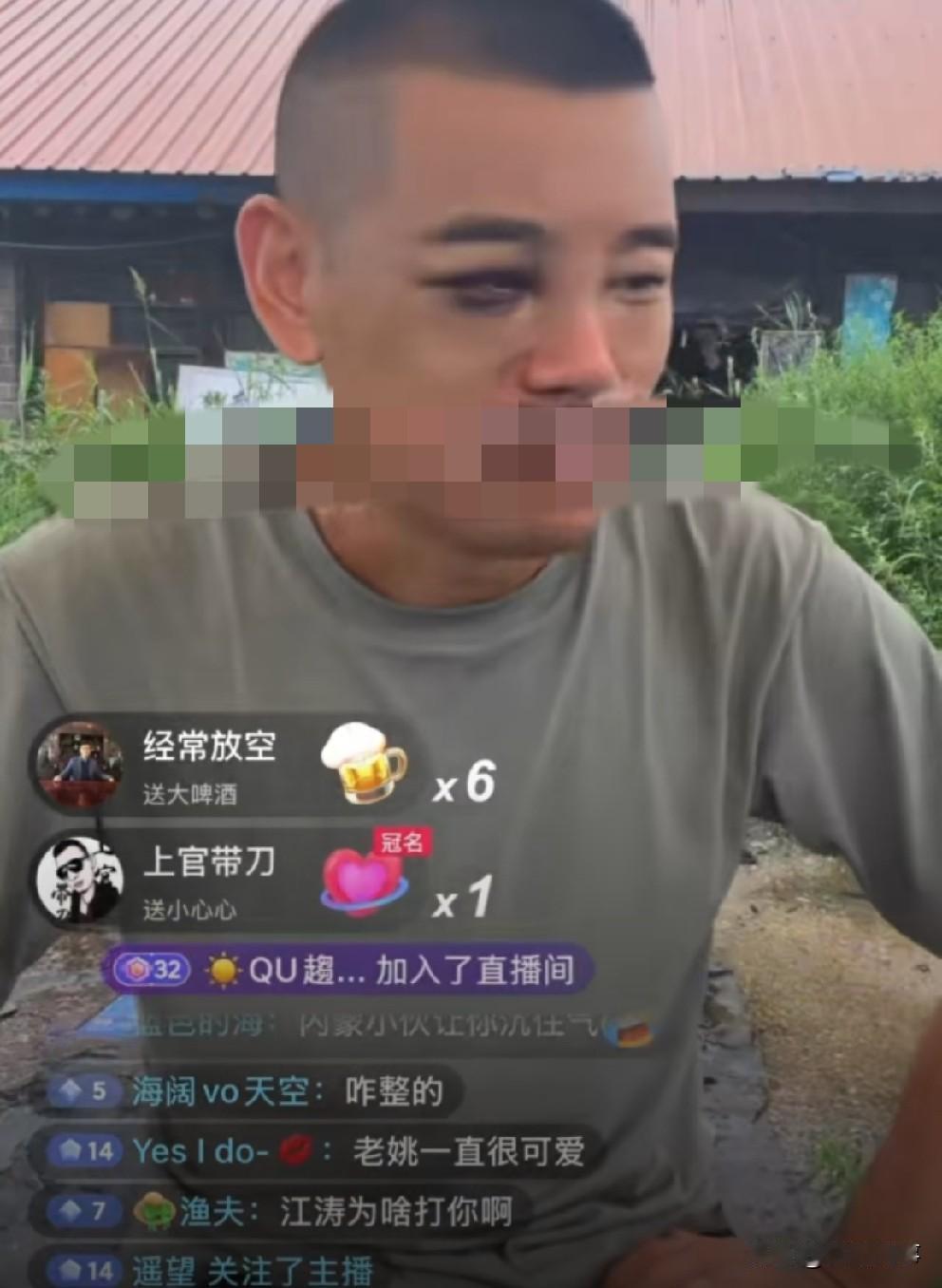 姚永纯“乌眼青”狼狈开播，破产患上严重抑郁躯体化！姚永纯去