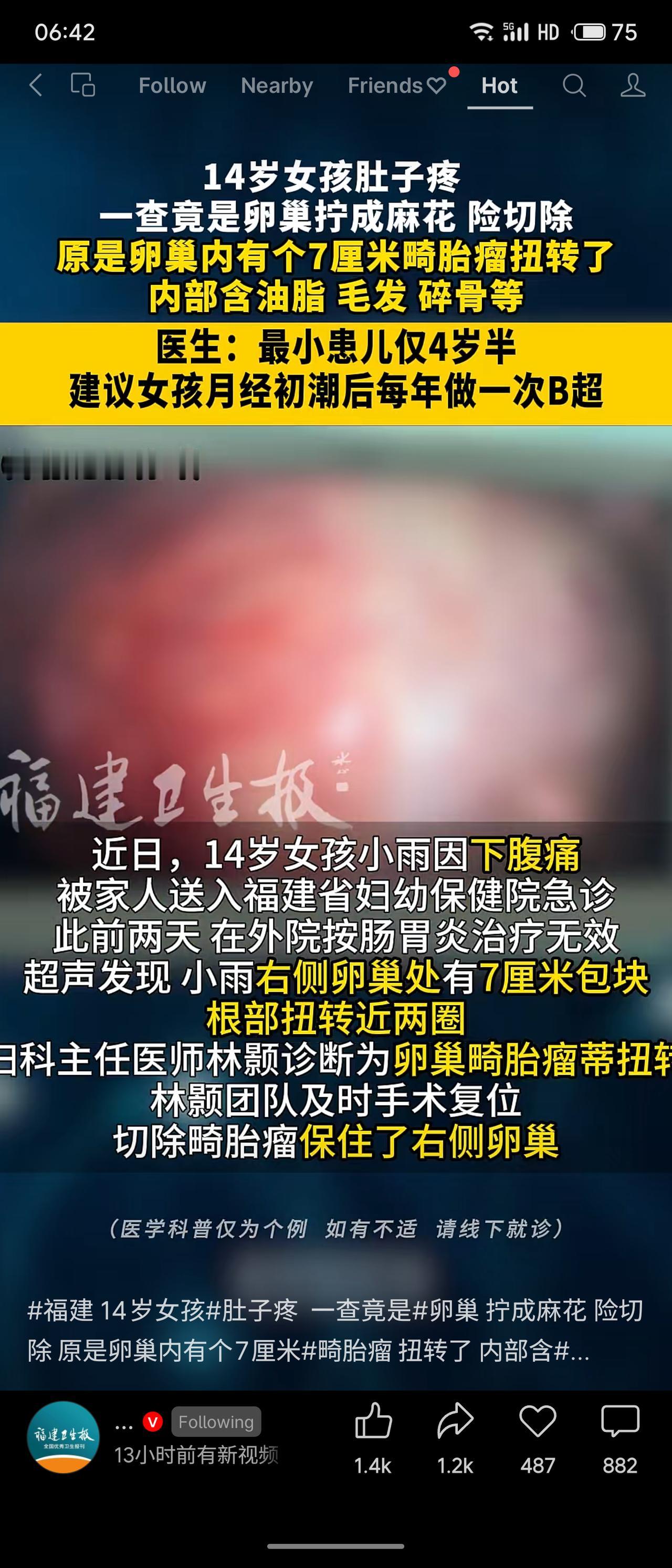 福建14岁女孩小雨因下腹痛急诊，外院误诊肠胃炎无效，超声发现右侧卵巢7厘米畸胎瘤