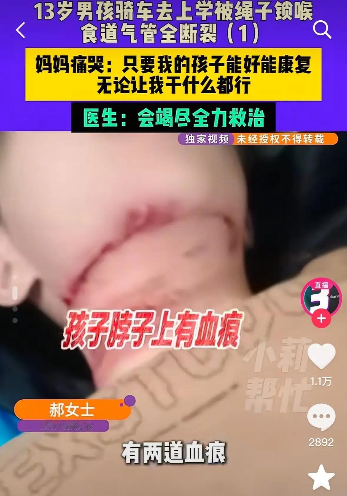 一根绳子，毁了一个孩子！看了河南13岁男孩被绳子割断气管是真的难受，他学习一直稳