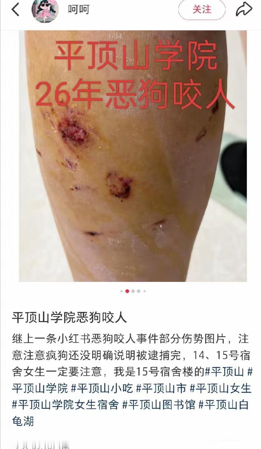 不能因为个别同学受伤，就断了猫狗的活路。毕竟在某些自诩是小动物爱心人士心中，人