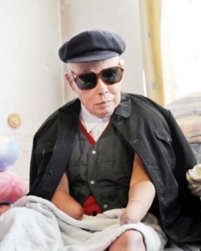 1950年，长津湖战役中，17岁的朱彦夫重伤昏迷，被美军补刀划开肚子，疼醒之后他