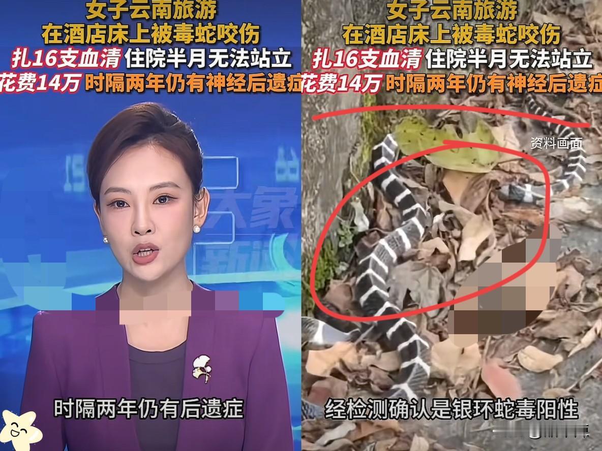 “命真大！”一女子和丈夫去云南普洱旅游时，在酒店的床上不幸被银环蛇咬伤，本以为