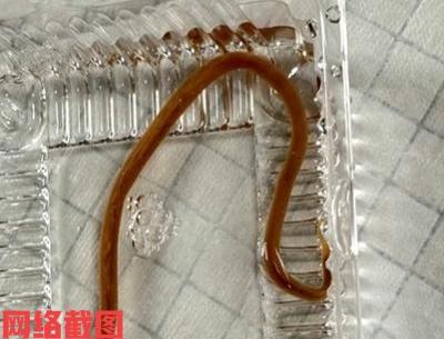 浙江金华有女子肚子老是反复疼痛。本以为吃坏东西过几天就好，这不还是疼痛难忍，