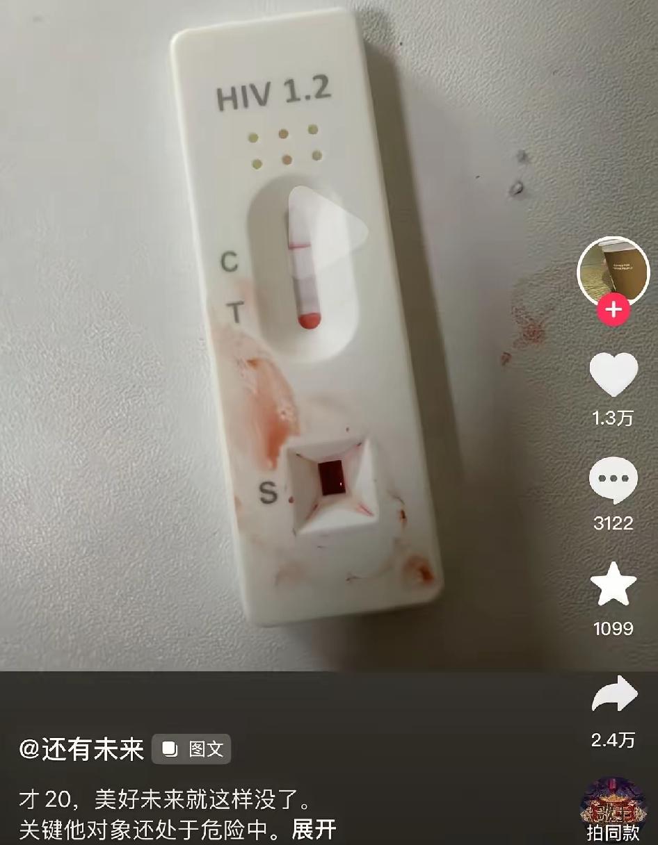 天哪，20岁已感染了，现在的孩子真是太乱了。很好奇，她说的小蓝上是啥意思？有了
