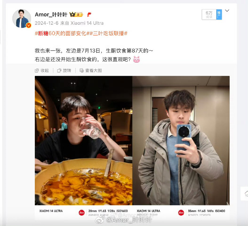 糖化脸和吃糖是什么关系左边生酮脸，右边碳水脸，我感觉还是纯吃肉帅啊。[墨镜]​​